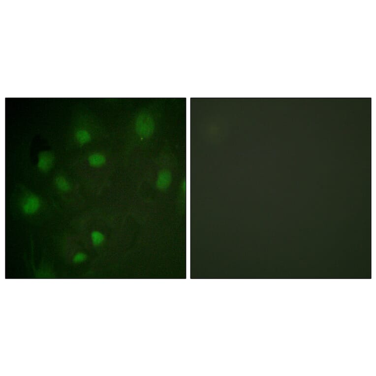 Immunofluorescence - Anti-IGF2R Antibody (B1051) - Antibodies.com