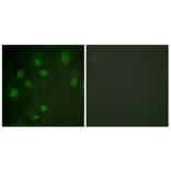 Immunofluorescence - Anti-IGF2R Antibody (B1051) - Antibodies.com