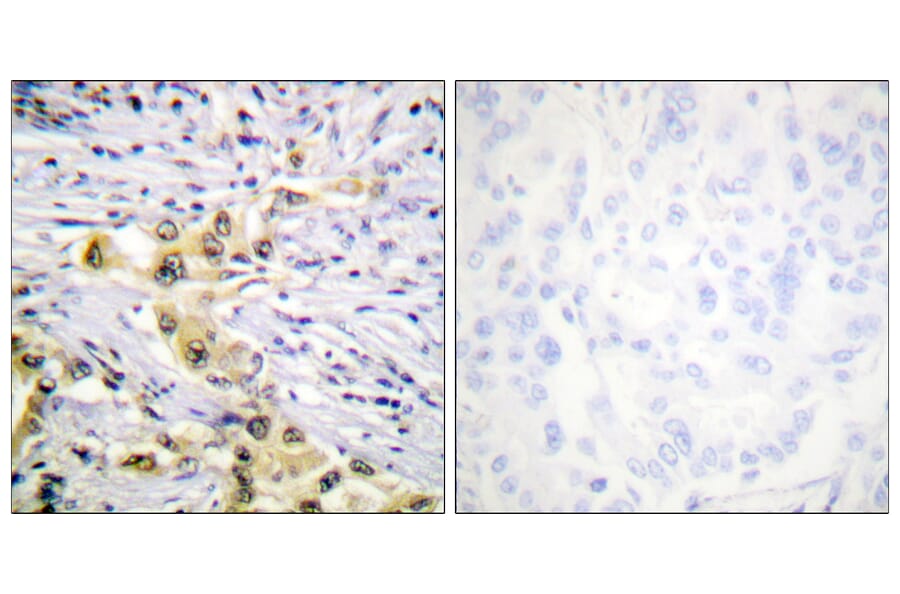 Immunohistochemistry - Anti-IGF2R Antibody (B1051) - Antibodies.com