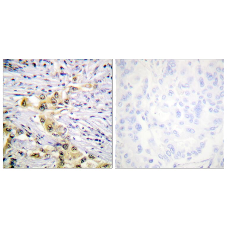 Immunohistochemistry - Anti-IGF2R Antibody (B1051) - Antibodies.com