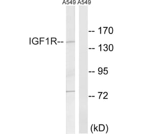 Western Blot - Anti-IGF1R Antibody (B8042) - Antibodies.com