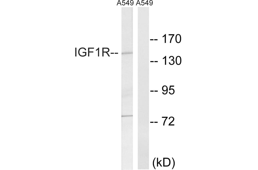 Western Blot - Anti-IGF1R Antibody (B8042) - Antibodies.com