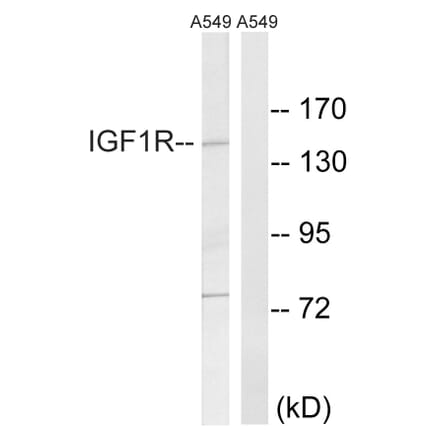 Western Blot - Anti-IGF1R Antibody (B8042) - Antibodies.com
