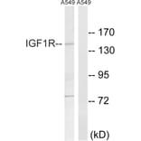 Western Blot - Anti-IGF1R Antibody (B8042) - Antibodies.com