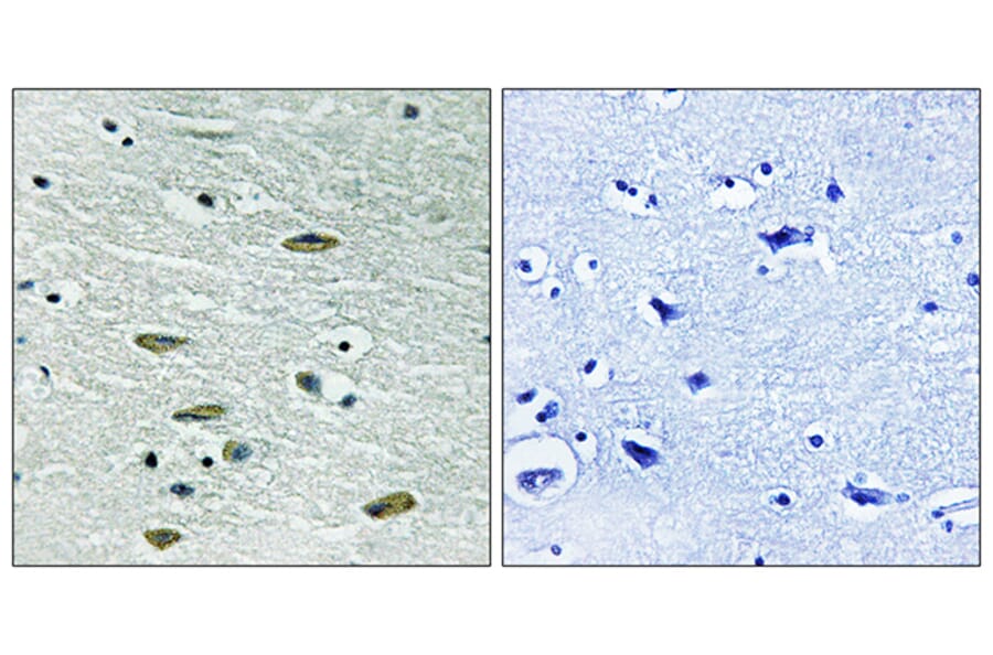 Immunohistochemistry - Anti-IGF1R Antibody (B8042) - Antibodies.com