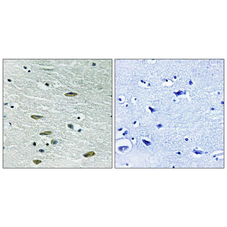 Immunohistochemistry - Anti-IGF1R Antibody (B8042) - Antibodies.com
