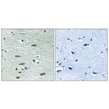 Immunohistochemistry - Anti-IGF1R Antibody (B8042) - Antibodies.com
