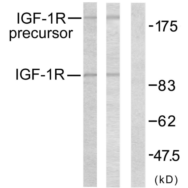 Western Blot - Anti-IGF1R Antibody (B7114) - Antibodies.com