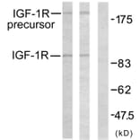 Western Blot - Anti-IGF1R Antibody (B7114) - Antibodies.com