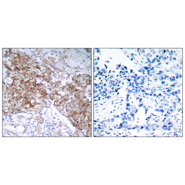 Immunohistochemistry - Anti-IGF1R Antibody (B7114) - Antibodies.com