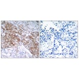 Immunohistochemistry - Anti-IGF1R Antibody (B7114) - Antibodies.com