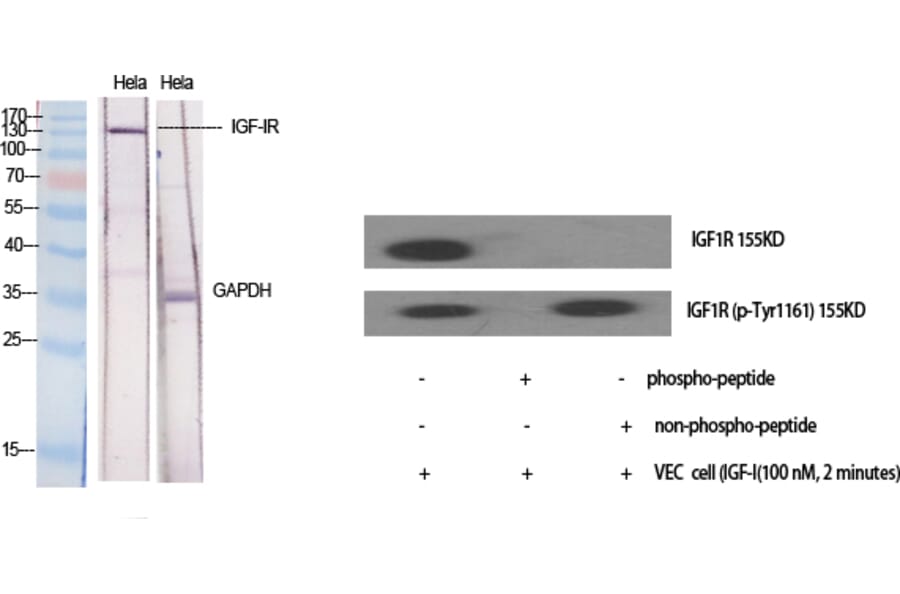 Western Blot - Anti-IGF1R Antibody (B7114) - Antibodies.com