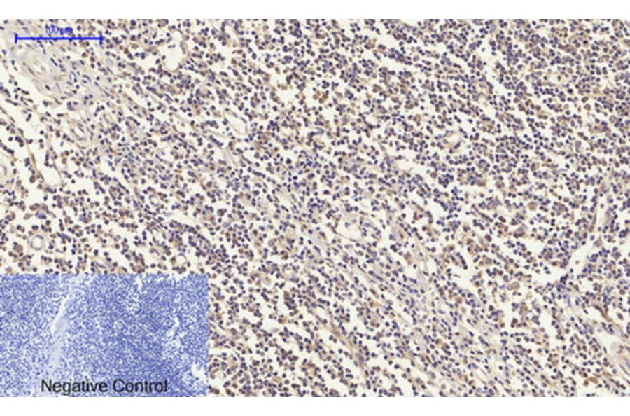 Immunohistochemistry - Anti-IGF1R Antibody (B7114) - Antibodies.com