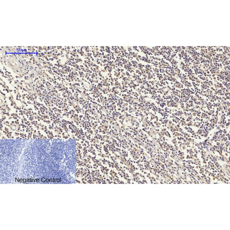 Immunohistochemistry - Anti-IGF1R Antibody (B7114) - Antibodies.com