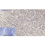 Immunohistochemistry - Anti-IGF1R Antibody (B7114) - Antibodies.com