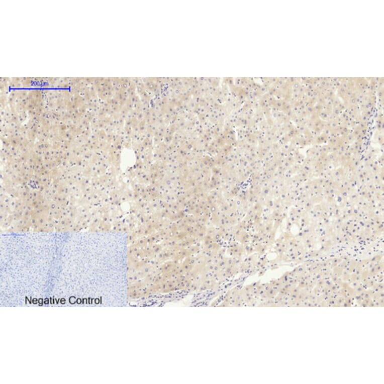 Immunohistochemistry - Anti-IGF1R Antibody (B7114) - Antibodies.com
