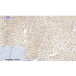 Immunohistochemistry - Anti-IGF1R Antibody (B7114) - Antibodies.com