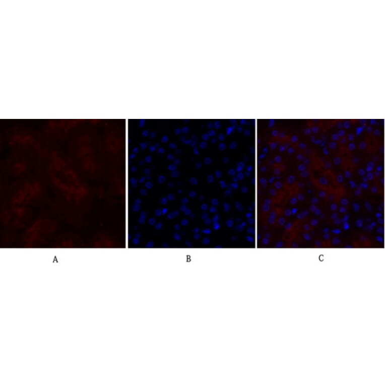 Immunofluorescence - Anti-IGF1R Antibody (B7114) - Antibodies.com