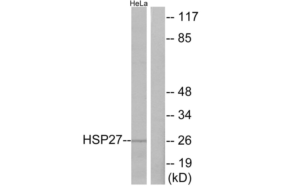 Western Blot - Anti-HSP27 Antibody (B7112) - Antibodies.com