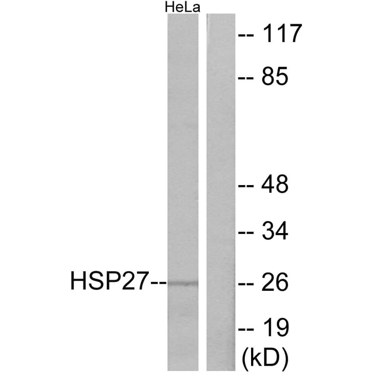 Western Blot - Anti-HSP27 Antibody (B7112) - Antibodies.com