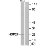 Western Blot - Anti-HSP27 Antibody (B7112) - Antibodies.com