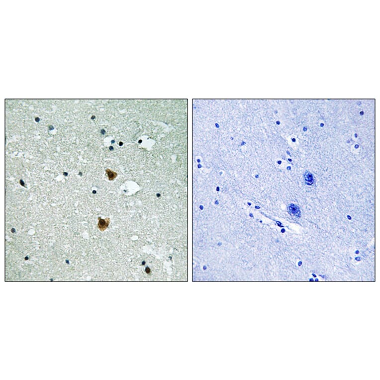 Immunohistochemistry - Anti-HSP27 Antibody (B7112) - Antibodies.com