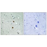 Immunohistochemistry - Anti-HSP27 Antibody (B7112) - Antibodies.com