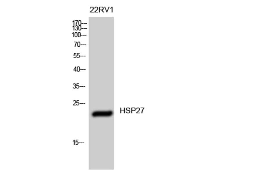 Western Blot - Anti-HSP27 Antibody (B7112) - Antibodies.com