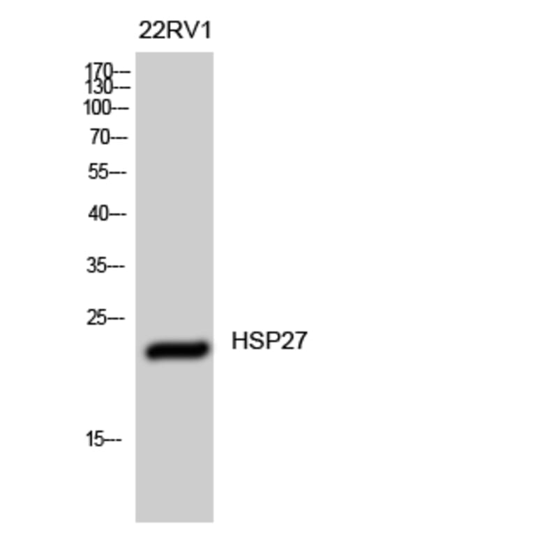 Western Blot - Anti-HSP27 Antibody (B7112) - Antibodies.com