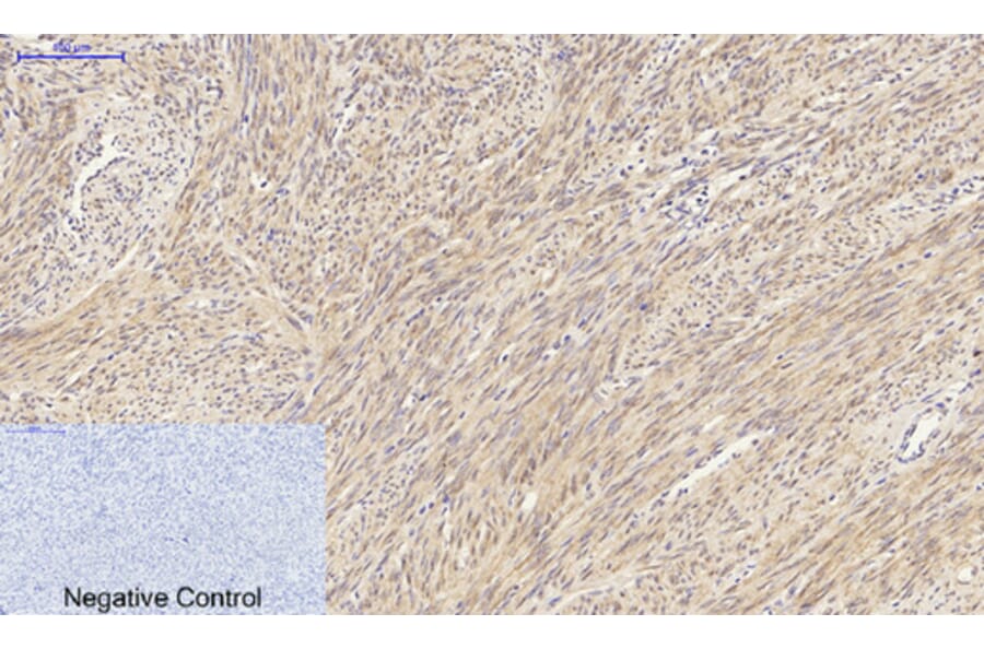 Immunohistochemistry - Anti-HSP27 Antibody (B7112) - Antibodies.com