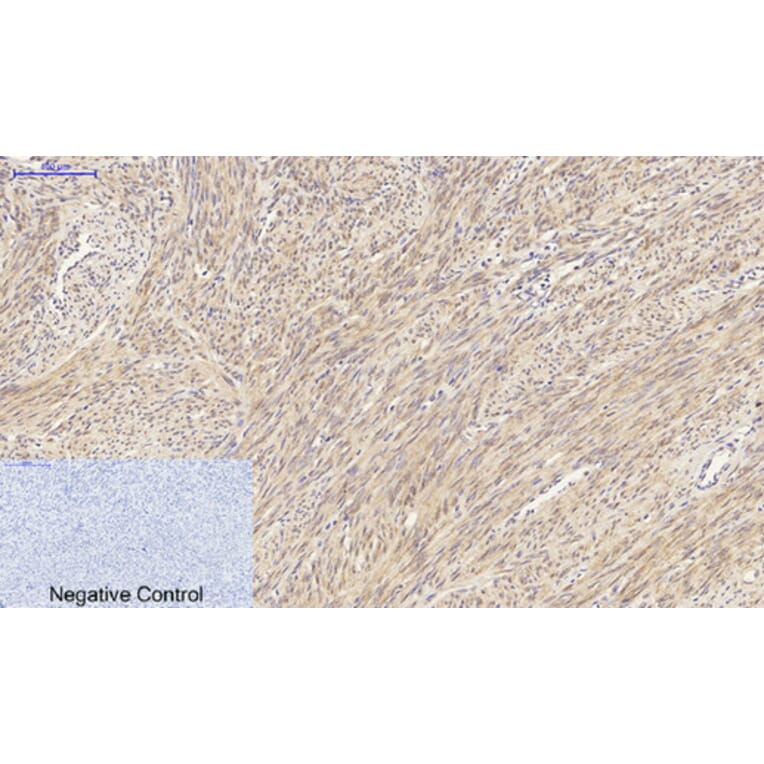 Immunohistochemistry - Anti-HSP27 Antibody (B7112) - Antibodies.com