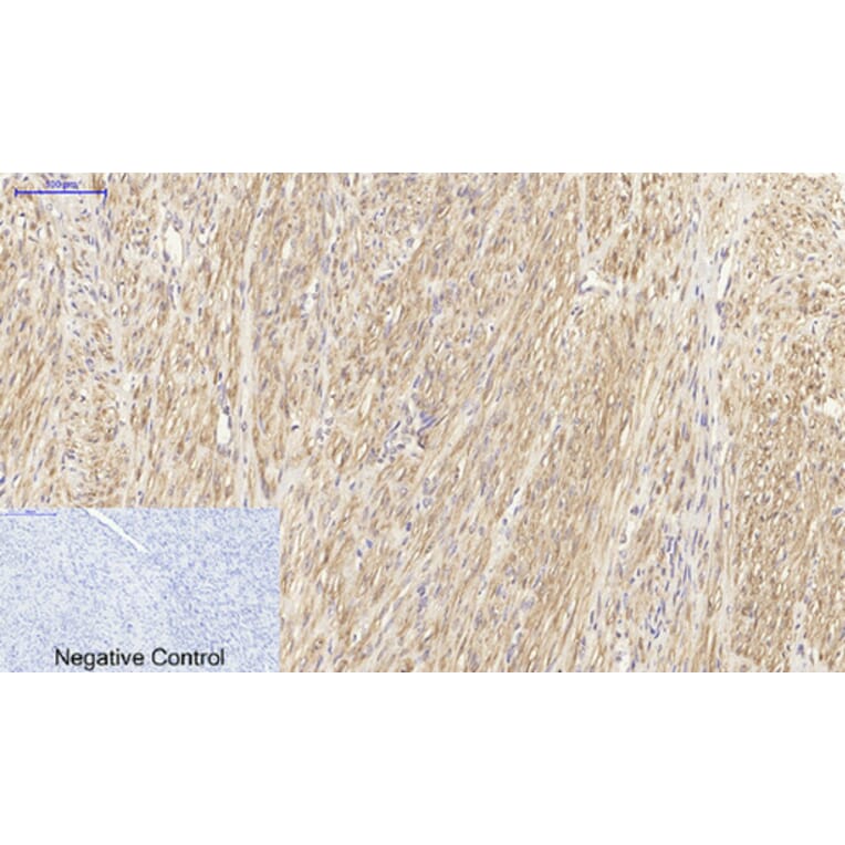 Immunohistochemistry - Anti-HSP27 Antibody (B7112) - Antibodies.com