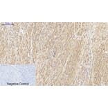 Immunohistochemistry - Anti-HSP27 Antibody (B7112) - Antibodies.com