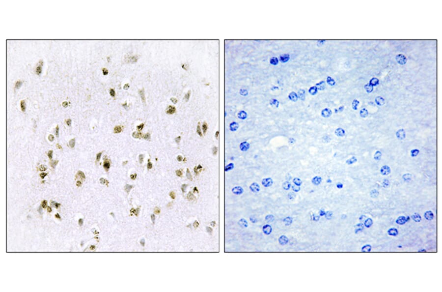 Immunohistochemistry - Anti-HMG17 Antibody (C10279) - Antibodies.com