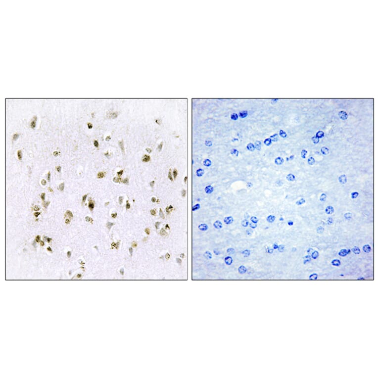 Immunohistochemistry - Anti-HMG17 Antibody (C10279) - Antibodies.com