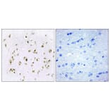 Immunohistochemistry - Anti-HMG17 Antibody (C10279) - Antibodies.com