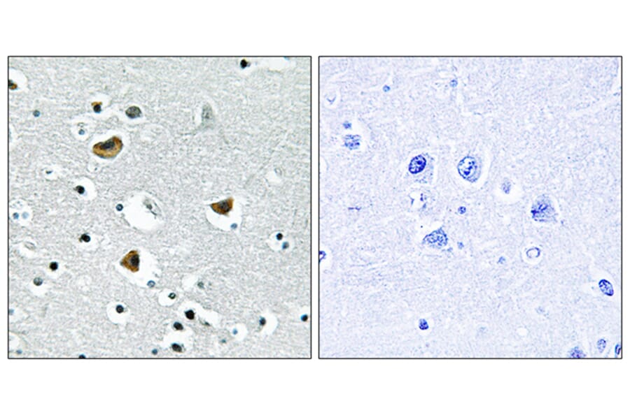 Immunohistochemistry - Anti-HMG17 Antibody (B1039) - Antibodies.com