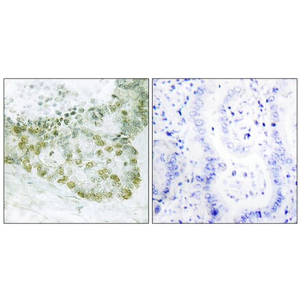 Immunohistochemistry - Anti-Hic-5 Antibody (B1036) - Antibodies.com