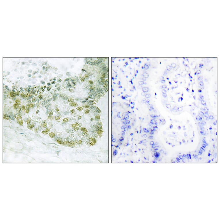 Immunohistochemistry - Anti-Hic-5 Antibody (B1036) - Antibodies.com