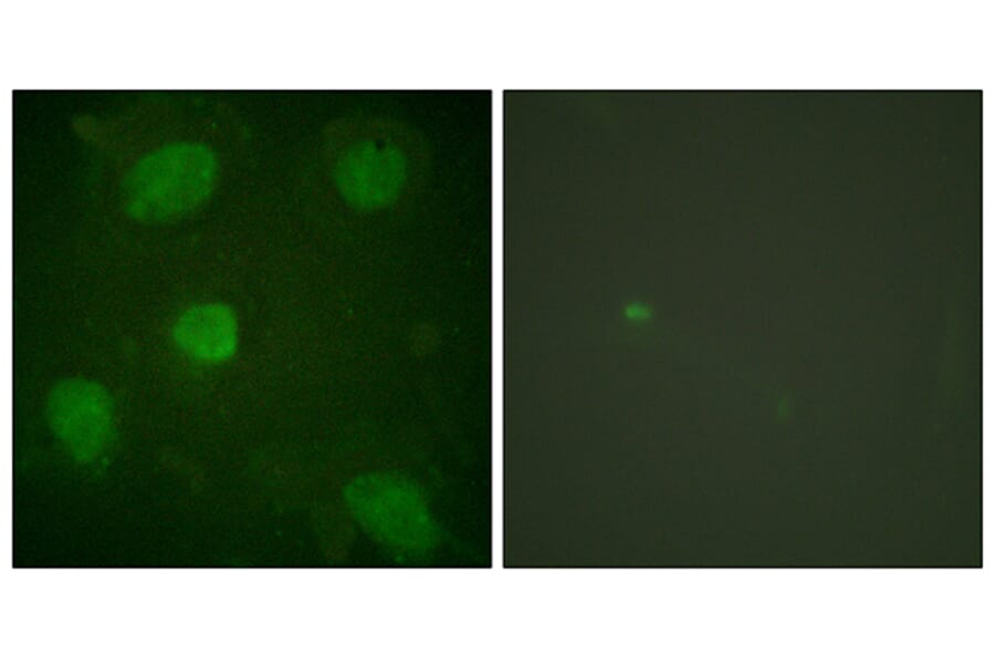 Immunofluorescence - Anti-Hic-5 Antibody (B1036) - Antibodies.com