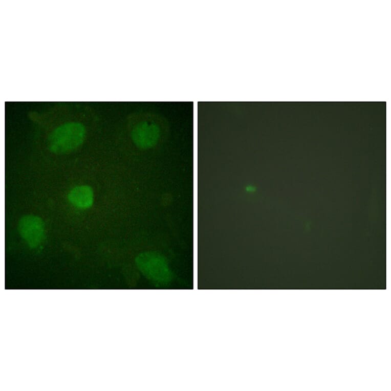 Immunofluorescence - Anti-Hic-5 Antibody (B1036) - Antibodies.com