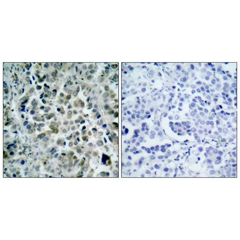 Immunohistochemistry - Anti-HDAC8 Antibody (B7102) - Antibodies.com