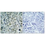 Immunohistochemistry - Anti-HDAC8 Antibody (B7102) - Antibodies.com