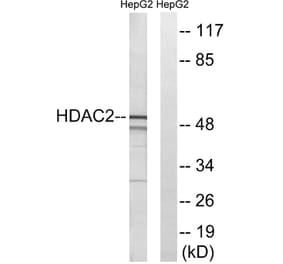 Western Blot - Anti-HDAC2 Antibody (B7099) - Antibodies.com