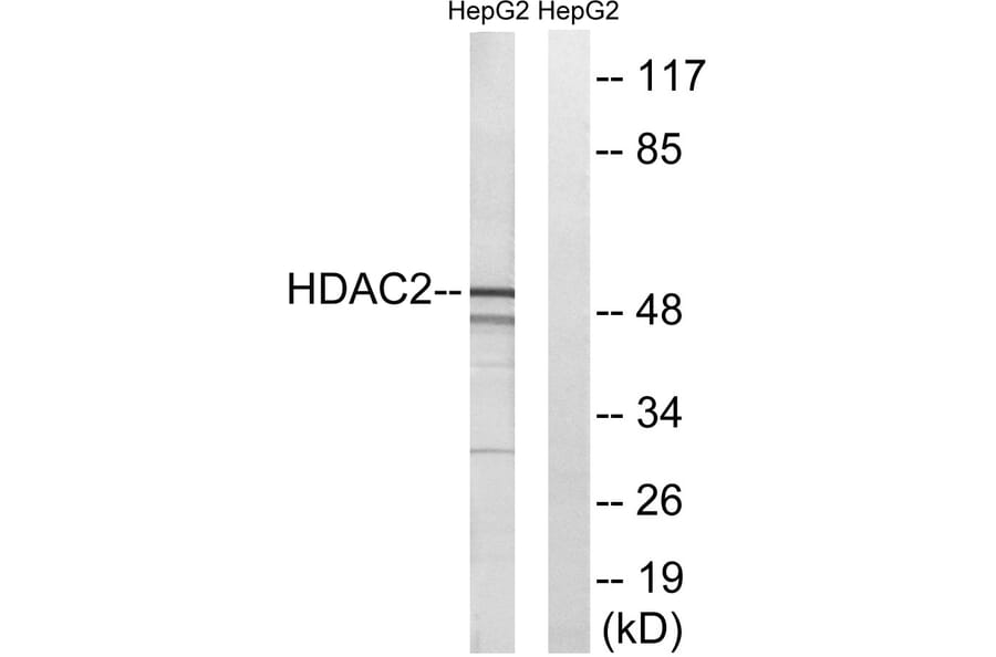 Western Blot - Anti-HDAC2 Antibody (B7099) - Antibodies.com