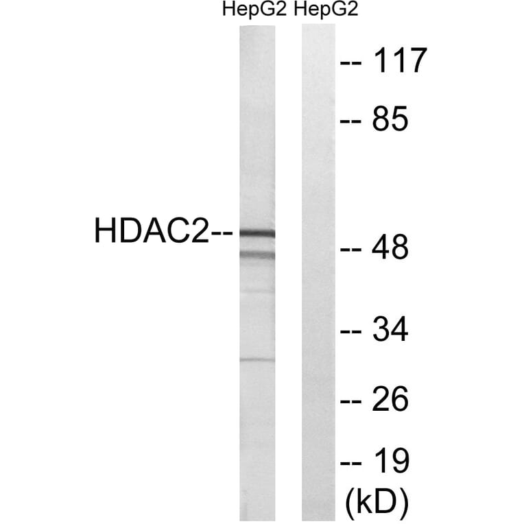 Western Blot - Anti-HDAC2 Antibody (B7099) - Antibodies.com