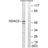 Western Blot - Anti-HDAC2 Antibody (B7099) - Antibodies.com