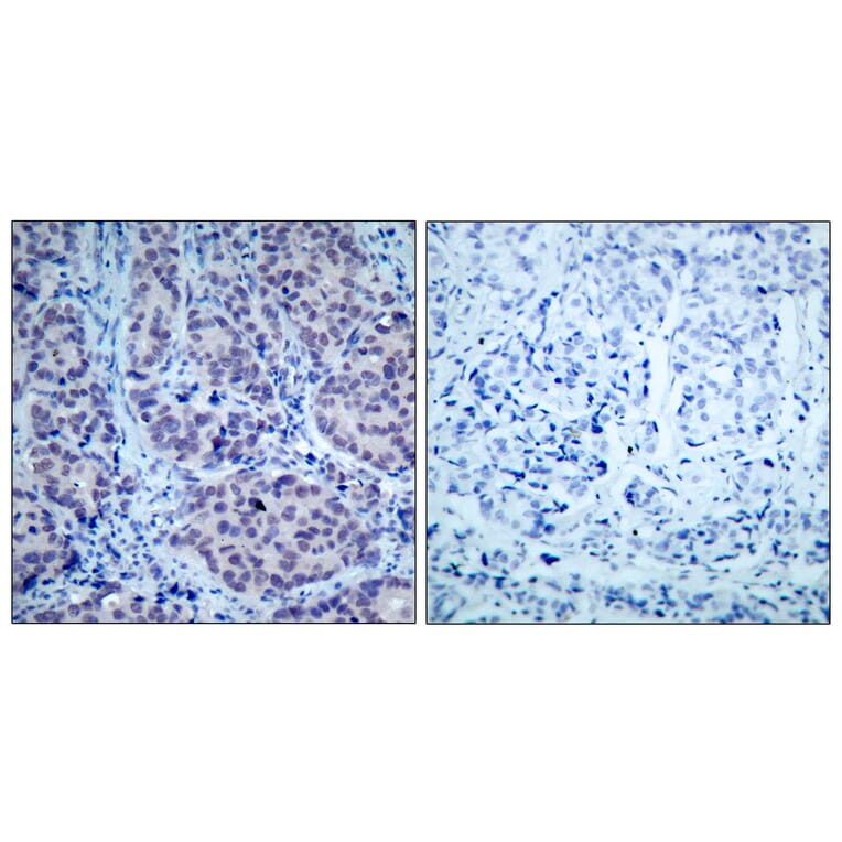 Immunohistochemistry - Anti-HDAC2 Antibody (B7099) - Antibodies.com