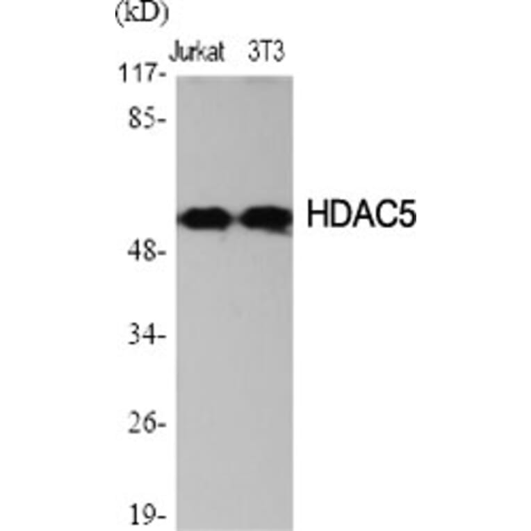 Western Blot - Anti-HDAC2 Antibody (B7099) - Antibodies.com