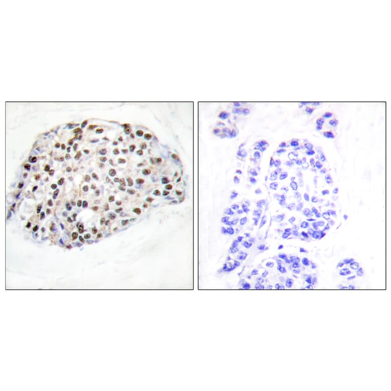 Immunohistochemistry - Anti-HDAC1 Antibody (B0793) - Antibodies.com